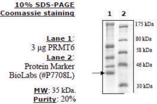 PRMT6 human recombinant, expressed in FreeStyle&#8482; 293-F cells, &#8805;70% (SDS-PAGE)