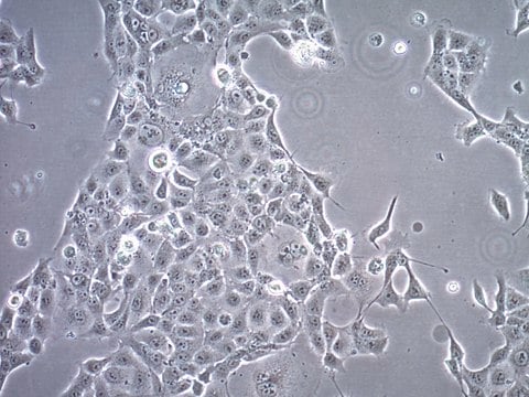 HCC827 GR6 Human Lung Adenocarcinoma Cell Line