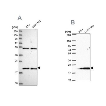 Anti-KIAA1143 antibody produced in rabbit Prestige Antibodies&#174; Powered by Atlas Antibodies, affinity isolated antibody, buffered aqueous glycerol solution