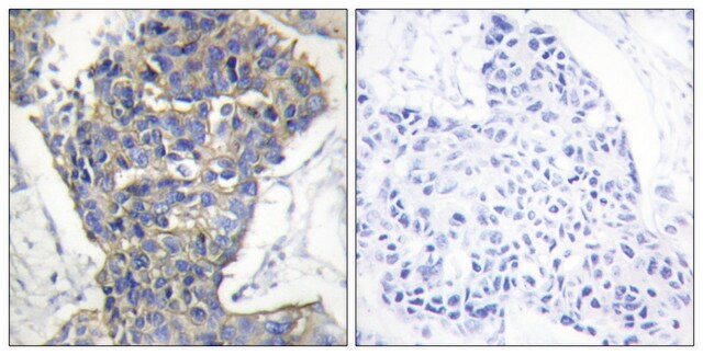 Anti-MUNC-18A antibody produced in rabbit affinity isolated antibody