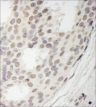 Rabbit anti-PPP1CA Antibody, Affinity Purified Powered by Bethyl Laboratories, Inc.