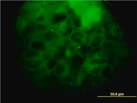 Monoclonal Anti-MVD antibody produced in mouse clone 2A7, purified immunoglobulin, buffered aqueous solution