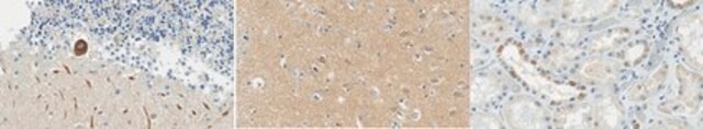 Anti-VAP-B Antibody, clone 3C6.2 clone 3C6.2, from mouse