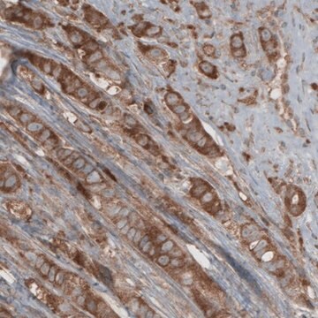 Monoclonal Anti-CARS antibody produced in mouse Prestige Antibodies&#174; Powered by Atlas Antibodies, clone CL2302, purified immunoglobulin, buffered aqueous glycerol solution