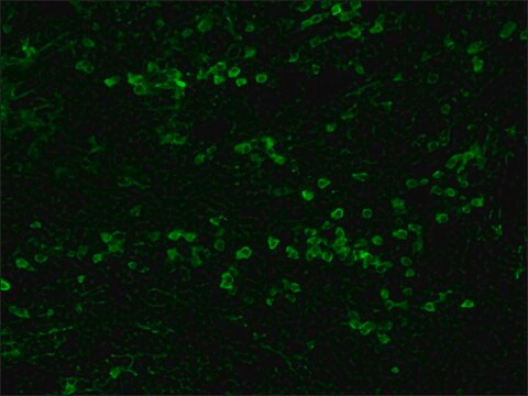 Anti-Rabbit IgG (whole molecule)–FITC antibody produced in goat affinity isolated antibody, buffered aqueous solution