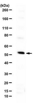 Anti-WTAP Antibody from rabbit, purified by affinity chromatography