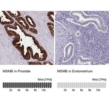 Anti-MSMB antibody produced in rabbit Prestige Antibodies&#174; Powered by Atlas Antibodies, affinity isolated antibody, buffered aqueous glycerol solution