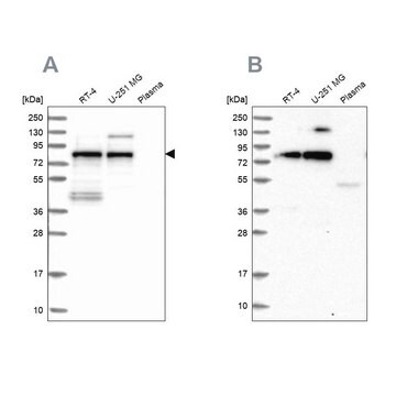 Anti-TNIP1 antibody produced in rabbit Prestige Antibodies&#174; Powered by Atlas Antibodies, affinity isolated antibody, buffered aqueous glycerol solution