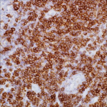 CD5 (SP19) Rabbit Monoclonal Antibody