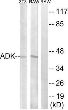 Anti-ADK antibody produced in rabbit affinity isolated antibody