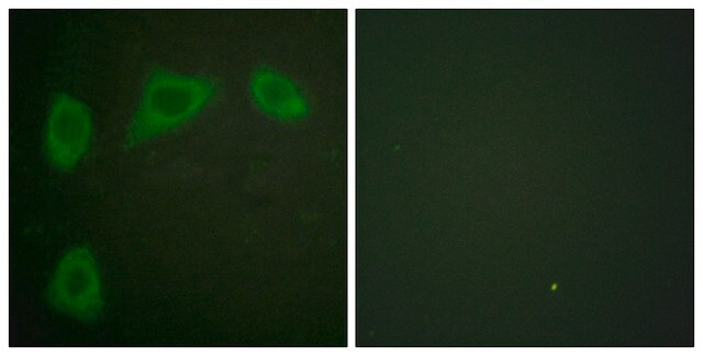 Anti-Caveolin-1 antibody produced in rabbit affinity isolated antibody