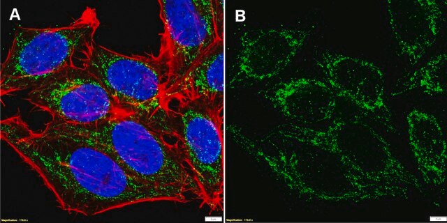 Anti-FIS1 Antibody, clone 1C7 ZooMAb&#174; Rabbit Monoclonal recombinant, expressed in HEK 293 cells