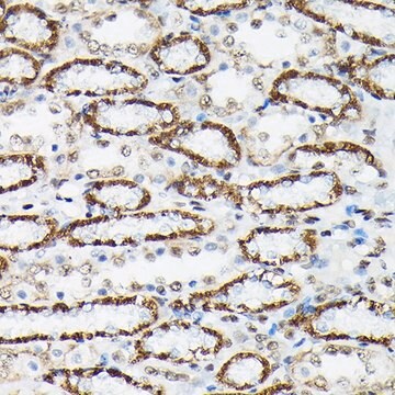 Anti-Phospho-FOXO3A-S425 antibody produced in rabbit