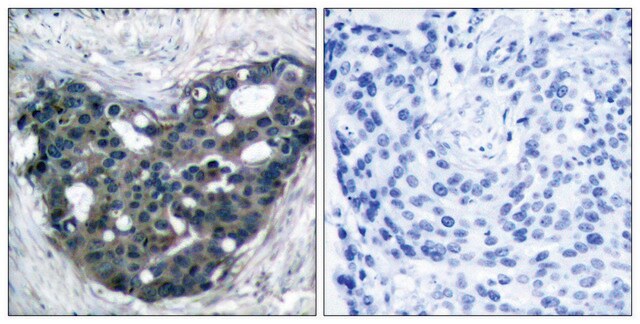 Anti-p56 DOK-3 antibody produced in rabbit affinity isolated antibody