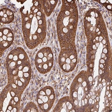 Anti-CTTN antibody produced in rabbit Prestige Antibodies&#174; Powered by Atlas Antibodies, affinity isolated antibody, buffered aqueous glycerol solution