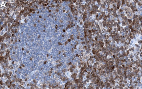 Anti-STAT5B Antibody, clone 2G13 ZooMAb&#174; Rabbit Monoclonal recombinant, expressed in HEK 293 cells