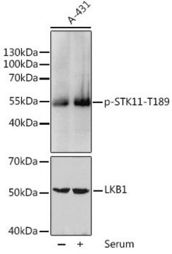 Anti-Phospho-STK11-T189 antibody produced in rabbit