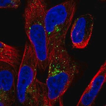 Anti-TMEM123 antibody produced in rabbit Prestige Antibodies&#174; Powered by Atlas Antibodies, affinity isolated antibody