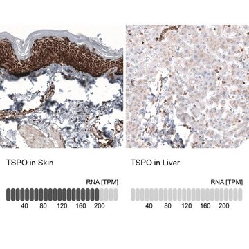 Anti-TSPO antibody produced in mouse Prestige Antibodies&#174; Powered by Atlas Antibodies, clone CL13359, purified by using Protein A, buffered aqueous glycerol solution