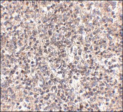 Anti-RSPO1 antibody produced in rabbit affinity isolated antibody, buffered aqueous solution