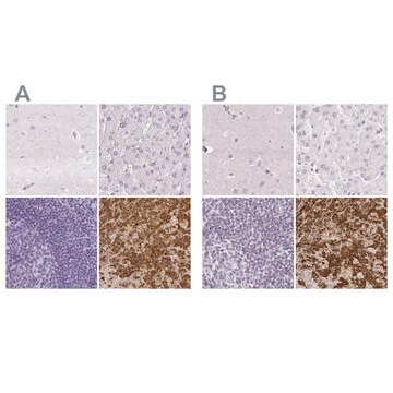 Anti-PRL antibody produced in rabbit Prestige Antibodies&#174; Powered by Atlas Antibodies, affinity isolated antibody