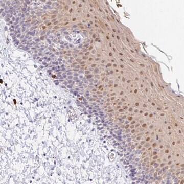 Anti-ZNF684 antibody produced in rabbit Prestige Antibodies&#174; Powered by Atlas Antibodies, affinity isolated antibody, buffered aqueous glycerol solution