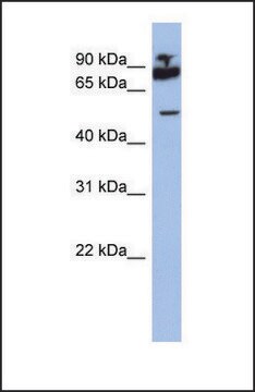 Anti-IKZF1 antibody produced in rabbit affinity isolated antibody