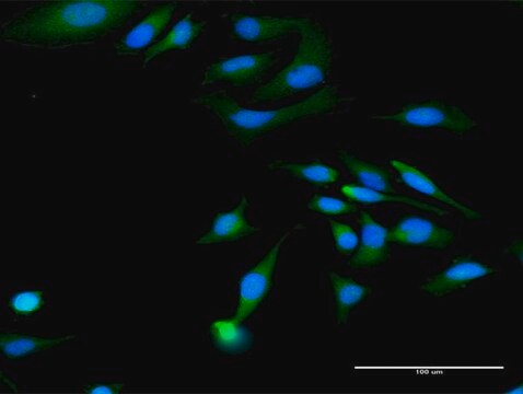 Anti-MAGED1 antibody produced in rabbit purified immunoglobulin, buffered aqueous solution