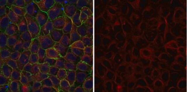 Anti-&#945;-Tubulin Antibody, clone DM1A, Alexa Fluor&#8482; 555 Conjugate clone DM1A, from mouse, ALEXA FLUOR&#8482; 555