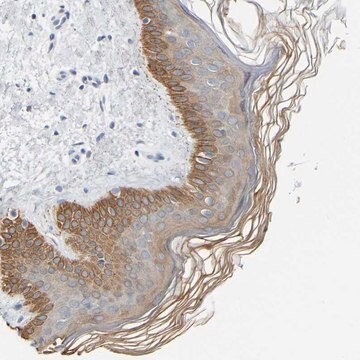 Anti-KRT76 antibody produced in rabbit Prestige Antibodies&#174; Powered by Atlas Antibodies, affinity isolated antibody, buffered aqueous glycerol solution, Ab2