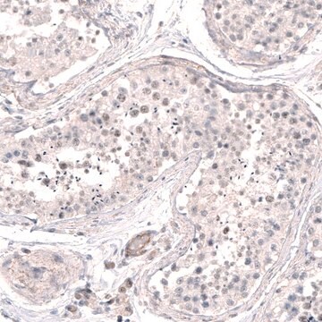 Anti-SMC6 antibody produced in rabbit Prestige Antibodies&#174; Powered by Atlas Antibodies, affinity isolated antibody, buffered aqueous glycerol solution