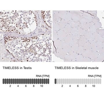 Anti-TIMELESS antibody produced in rabbit Prestige Antibodies&#174; Powered by Atlas Antibodies, affinity isolated antibody, buffered aqueous glycerol solution