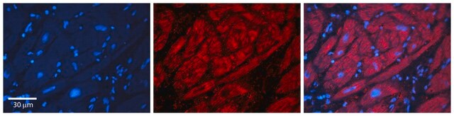 Anti-ADH1B antibody produced in rabbit affinity isolated antibody