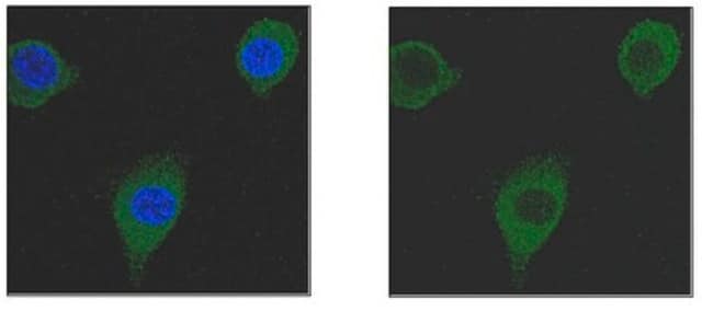 Anti-Transgelin/SM22a Antibody, clone 20F2.2 clone 20F2.2, from mouse