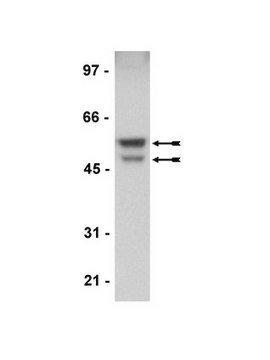 Anti-GSK3&#945;/&#946; Antibody, rabbit monoclonal Upstate&#174;, from rabbit