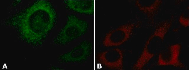 Anti-Cyclophilin B antibody, Mouse monoclonal clone CYPB-3, purified from hybridoma cell culture