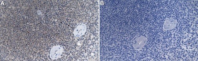 Anti-Interleukin-21 Antibody, clone 2B13 ZooMAb&#174; Rabbit Monoclonal recombinant, expressed in HEK 293 cells