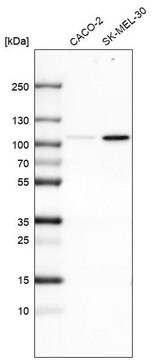 Monoclonal Anti-SOX6 antibody produced in mouse Prestige Antibodies&#174; Powered by Atlas Antibodies, clone CL5685, purified immunoglobulin, buffered aqueous glycerol solution