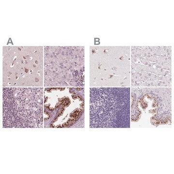 Anti-KIAA1324 antibody produced in rabbit Prestige Antibodies&#174; Powered by Atlas Antibodies, affinity isolated antibody