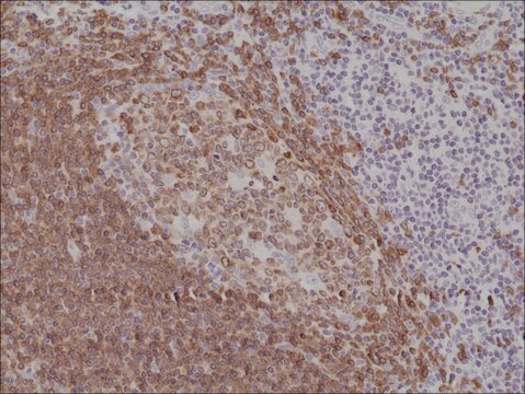 Anti-CD79a (C-term) antibody, Rabbit Monoclonal recombinant, expressed in HEK 293 cells, clone RM297, purified immunoglobulin