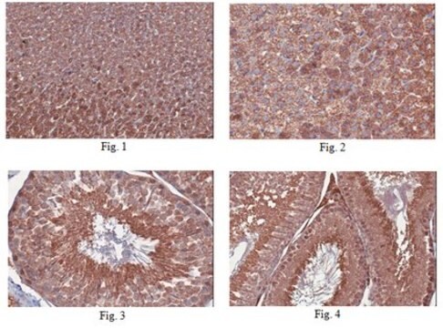 Anti-Cytochrome P450 (scc) Antibody, a.a. 509-526 from rabbit, purified by affinity chromatography