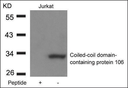 Anti-CCDC106 antibody produced in rabbit affinity isolated antibody