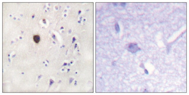 Anti-KIR6.2 antibody produced in rabbit affinity isolated antibody