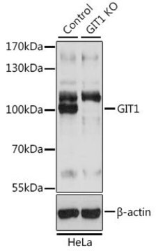 Anti-GIT1 antibody produced in rabbit