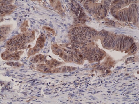 Anti-p16ink4a (CDKN2A) antibody, Rabbit monoclonal recombinant, expressed in HEK 293 cells, clone RM267, purified immunoglobulin