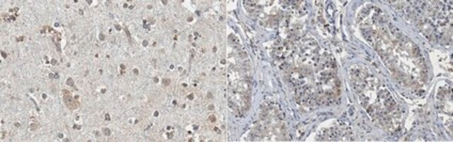 Anti-FMR1polyG Antibody, clone 8FM-2F7 ascites fluid, clone 8FM-2F7, from mouse