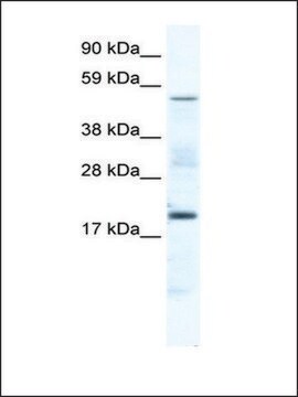 Anti-CSNK1G1 antibody produced in rabbit IgG fraction of antiserum