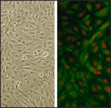 Human Brachiocephalic Artery Endothelial Cells: HBcAEC, adult