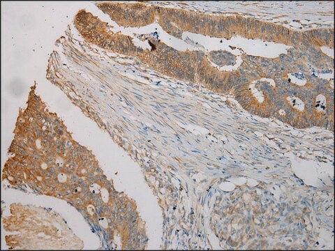 Anti-TUBA1C affinity isolated antibody