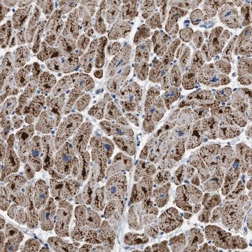 Anti-ETFB antibody produced in rabbit Prestige Antibodies&#174; Powered by Atlas Antibodies, affinity isolated antibody, buffered aqueous glycerol solution, Ab3